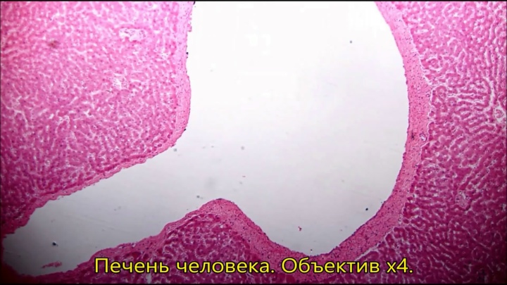 Печень человека. Вид в микроскоп с видеоокуляром ToupCam U3CMOS05100KPA
