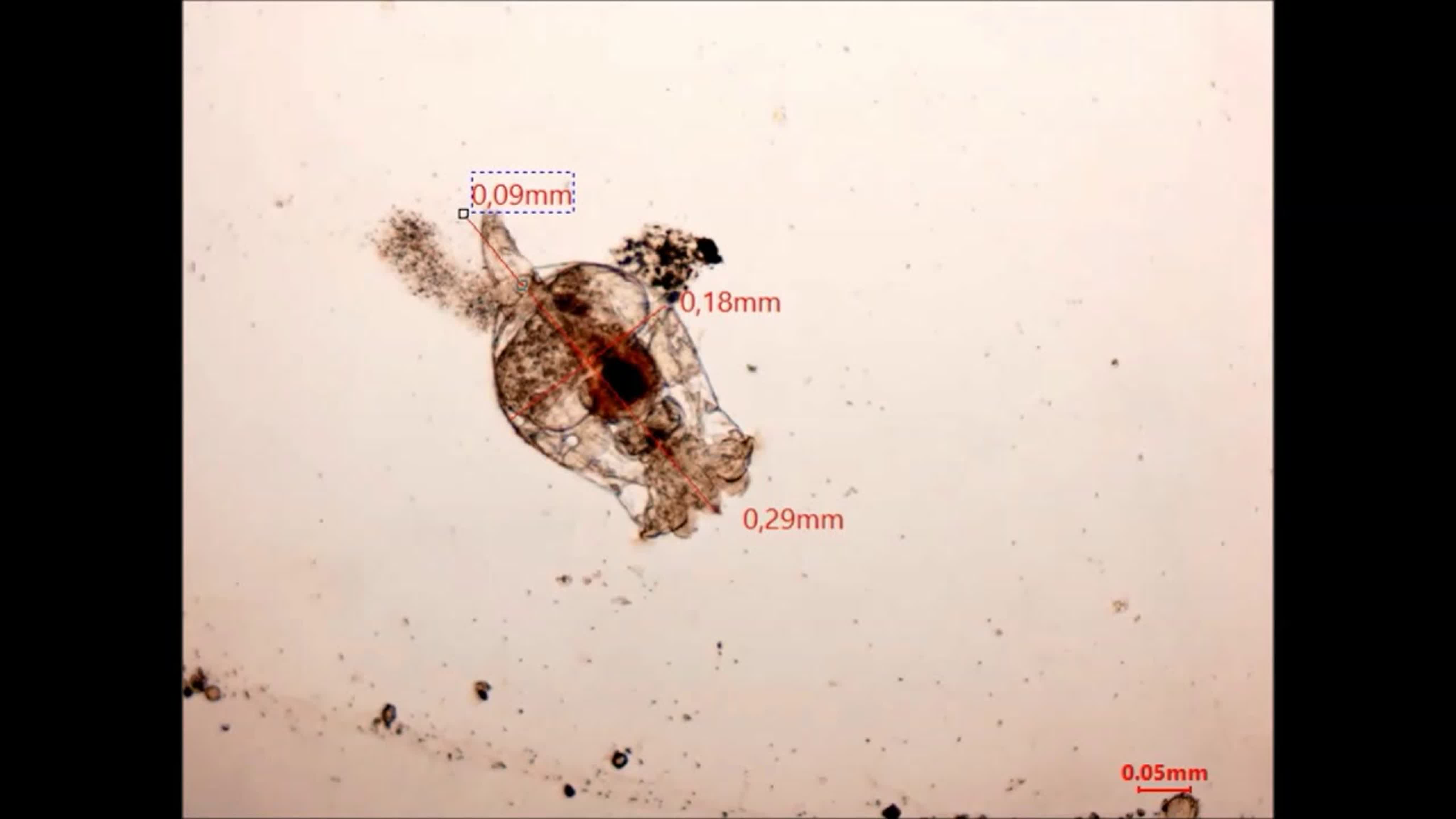 Коловратка.  Вид в микроскоп.